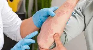 Molekulare Diagnostik einfach erklärt